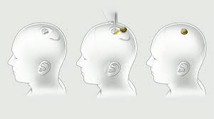 neuralink image<br />
